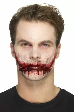 Stitched Smile Prosthetic